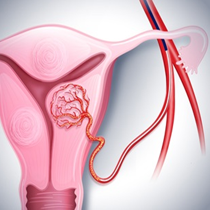 Surgeon for Transvaginal Oocyte Retrieval in Jalandhar