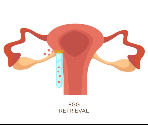 Surgeon for Transvaginal Oocyte Retrieval in Jalandhar